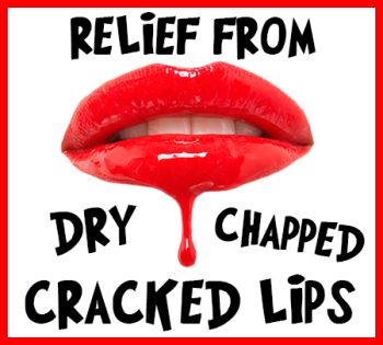 Highlands Ranch dentist, Dr. Tyler Twiss of Twiss Dental, tells you how to relieve your dry, chapped, and cracked lips!