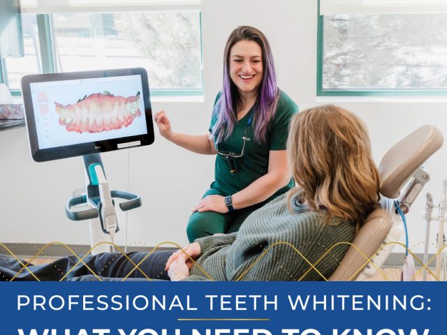 What You Need to Know About Professional Teeth Whitening (featured image)