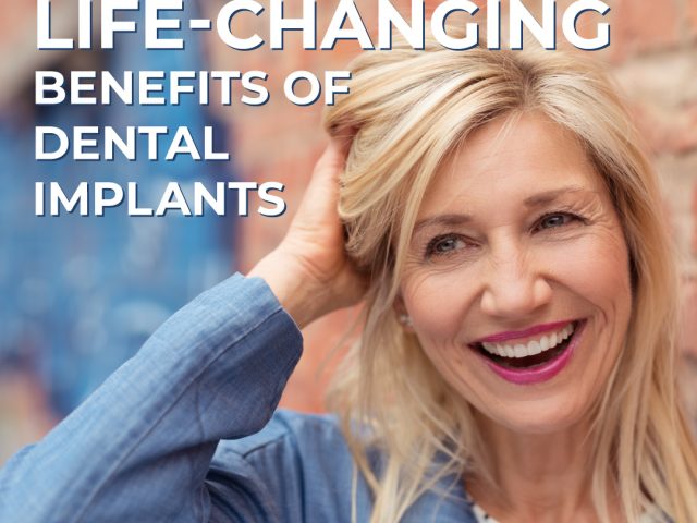 The Life-Changing Benefits of Dental Implants (featured image)